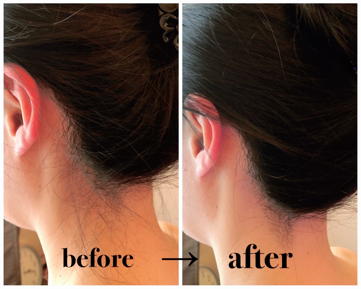 美肌脱毛 これから人気のうなじ脱毛 サロン ド ノーブル 大阪府 枚方市 くずは オーガニックエステ 痩身 脱毛